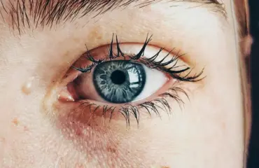 des yeux sains – rÉgime et supplÉments DES YEUX SAINS – RÉGIME ET SUPPLÉMENTS