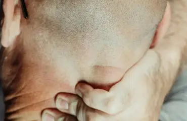 Cou tendu et migraine - cela peut être causé par le muscle trapèze