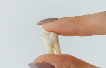 Ce que vos dents de sagesse cachent pourrait un jour vous sauver la vie